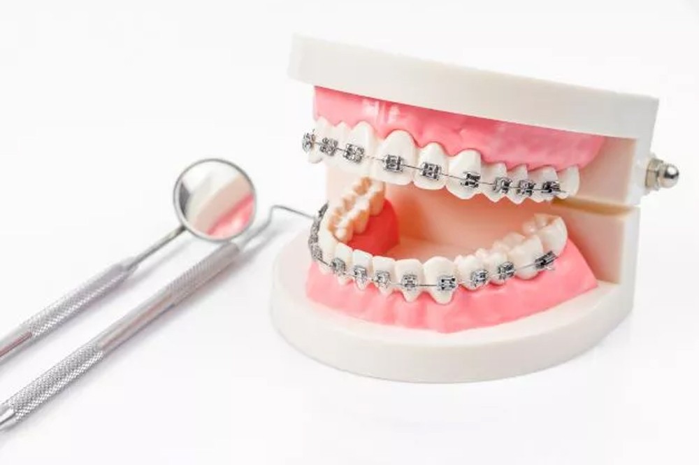 歯並び矯正専門プログラム「スマイルクラブ」を提供しています