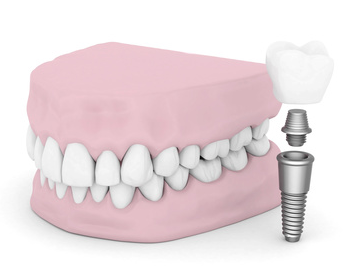 痛みが苦手な方も安心して治療を受けられます