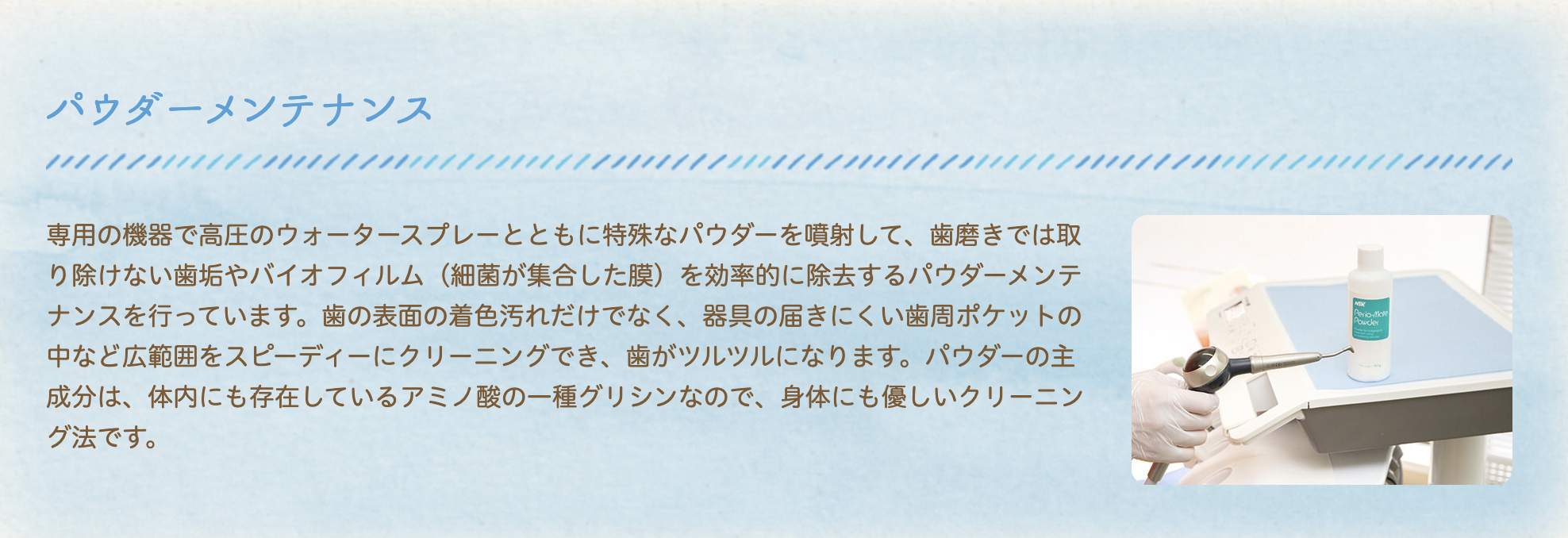 オータワ歯科クリニックでは、パウダーメンテナンスによるクリーニングを行っています