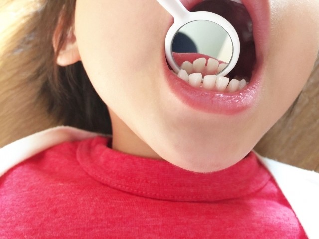 お子様の成長段階に合わせた診療を行い、健康な歯を育てるお手伝いをしています。