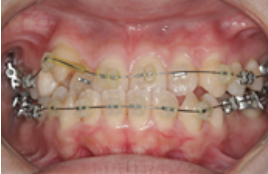 患者様一人ひとりに合わせた最適な治療を提供し、長期的な治療をサポートしています。