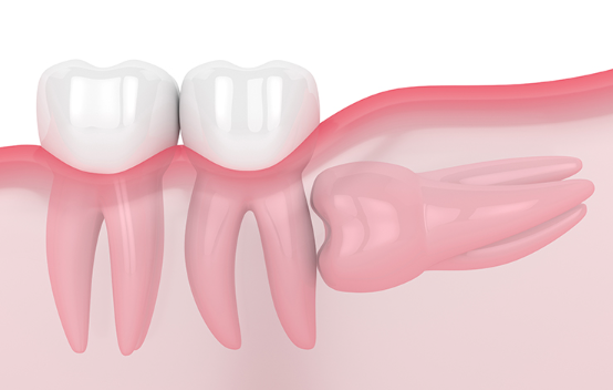 口腔外科領域もお任せください