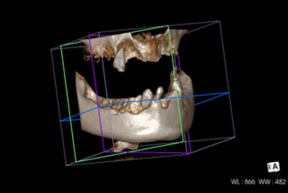 患者様一人ひとりに合わせた、適切な治療を提供いたします