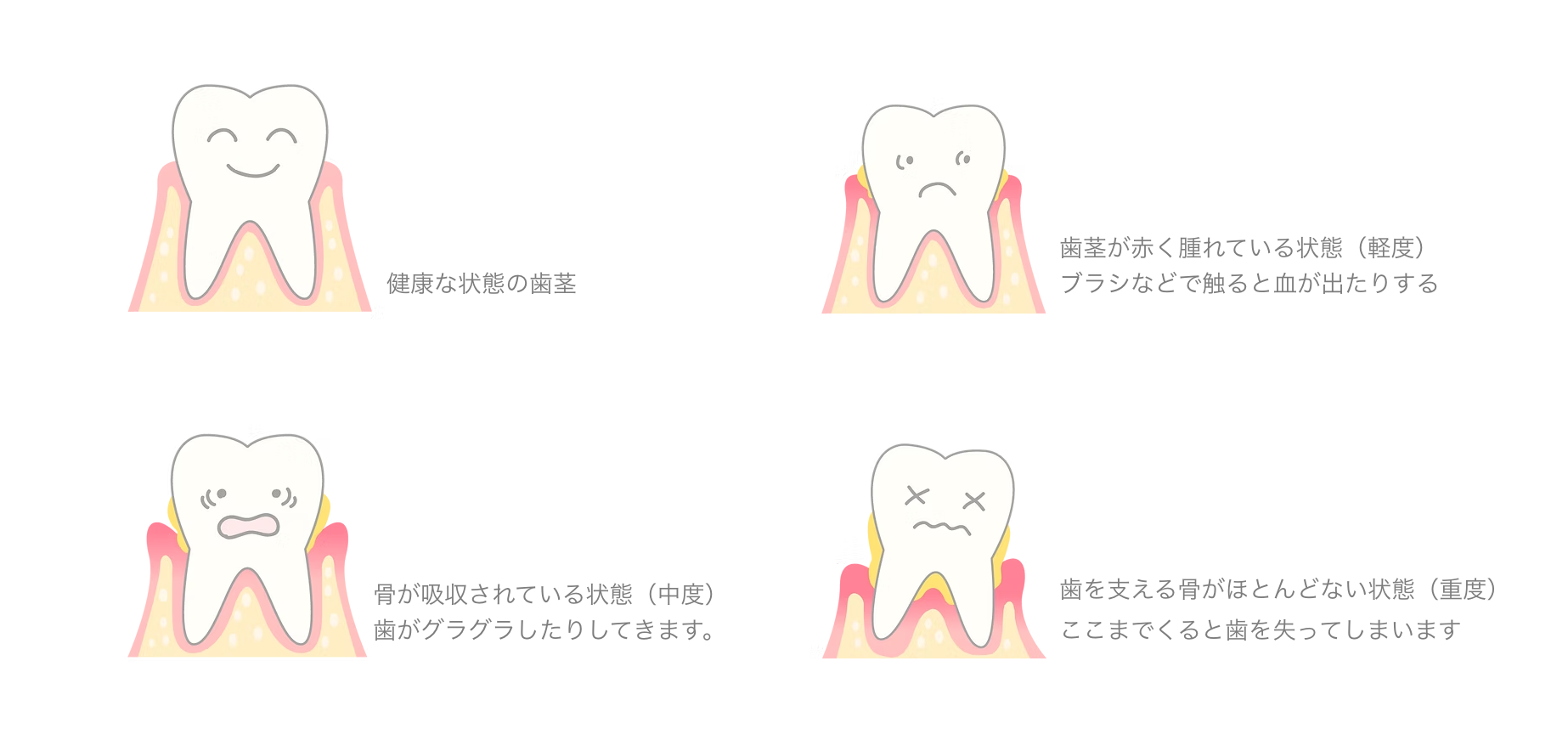 患者様の歯茎の状態を丁寧に診断し、適切な治療を行います
