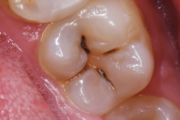 ※画像はイメージです