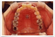 見た目の美しさだけでなく全身の健康を見据えた矯正治療に注力しています