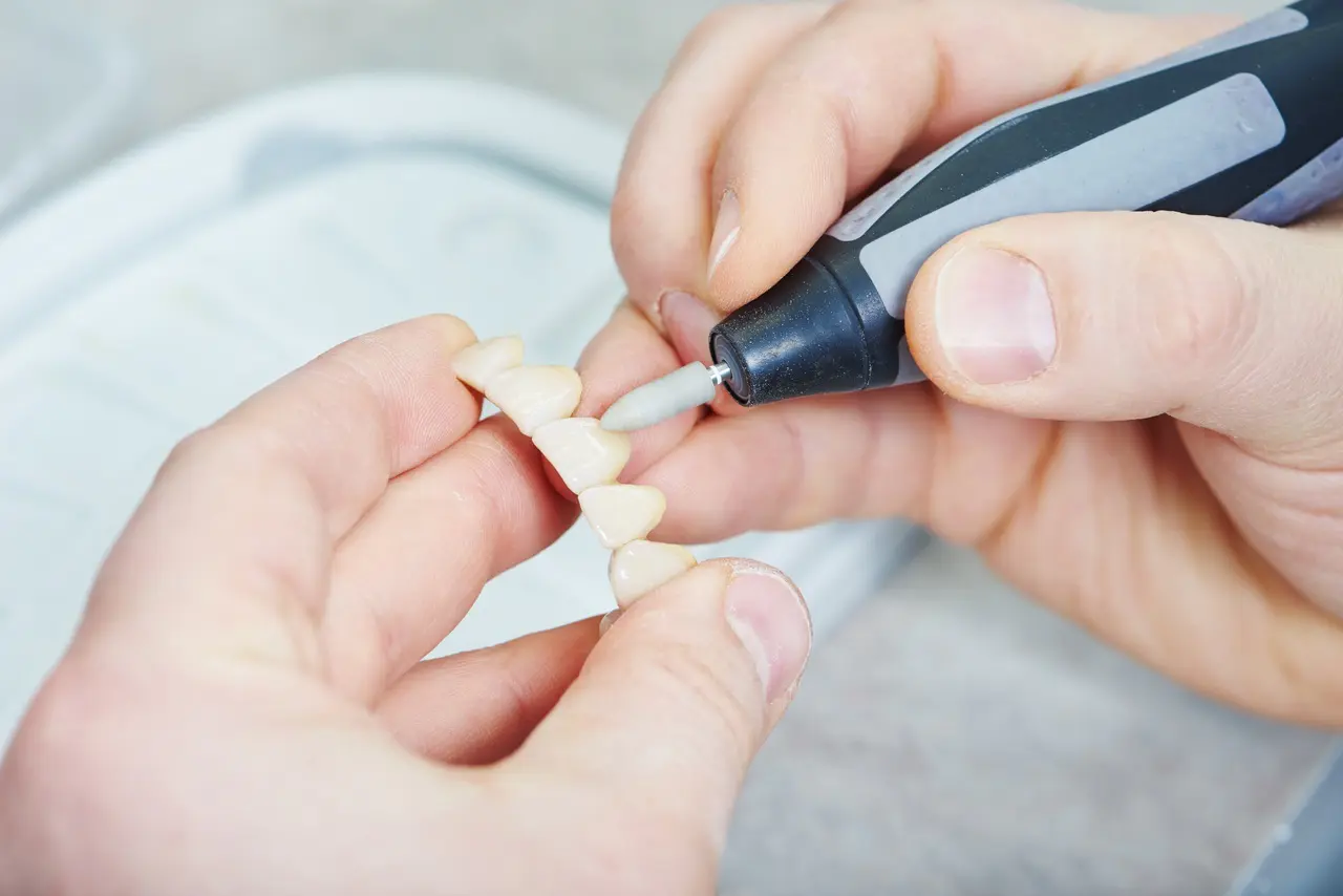 高品質な白い詰め物・被せ物を、身近な価格で提供