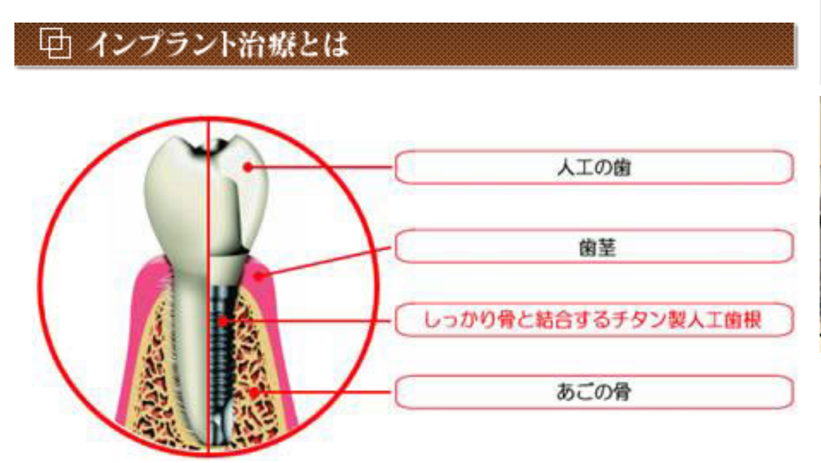 患者様の自然な噛み心地と快適な生活を取り戻すことを目指しています