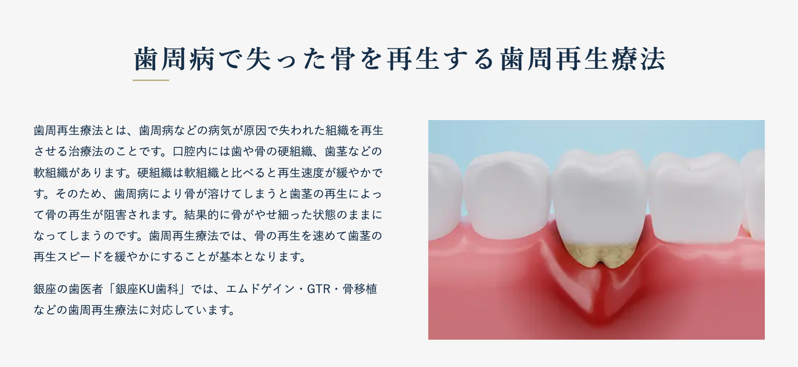 歯周病などが原因で失われた骨や歯周組織を回復させる歯周再生療法を行っています