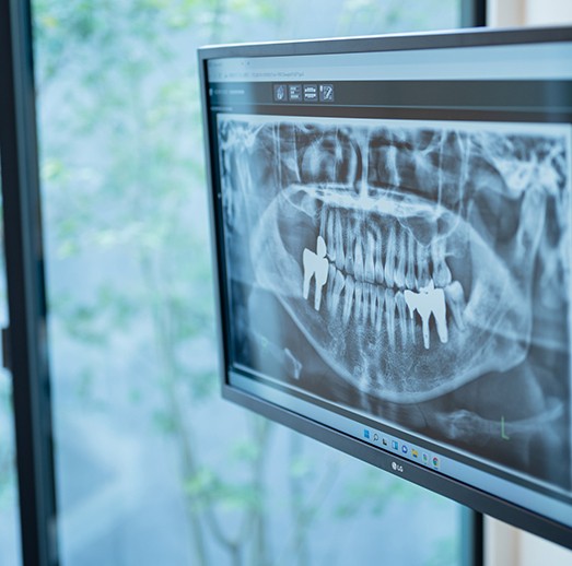 院長は口腔外科を専門として研鑽を積んでいます