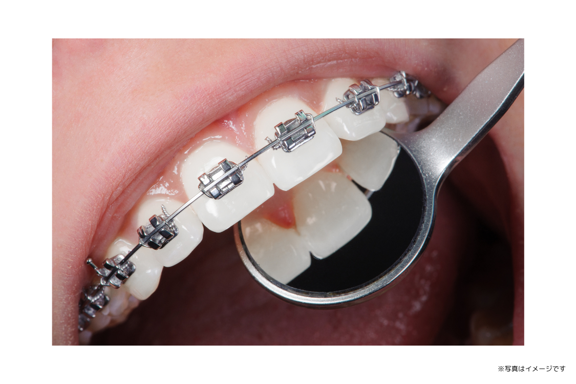 見た目だけでなく、口腔全体の健康を守る矯正歯科治療を提供します。