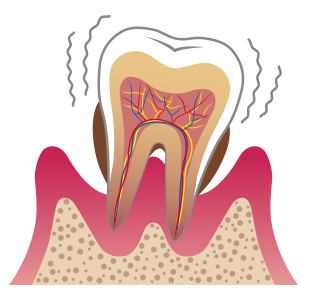 日々のケアが大切です