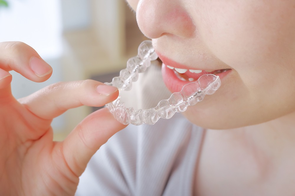 クリアアライナーを取り扱っています