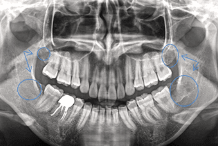 CTと専門機器を駆使した安全で負担の少ない口腔外科処置を提供