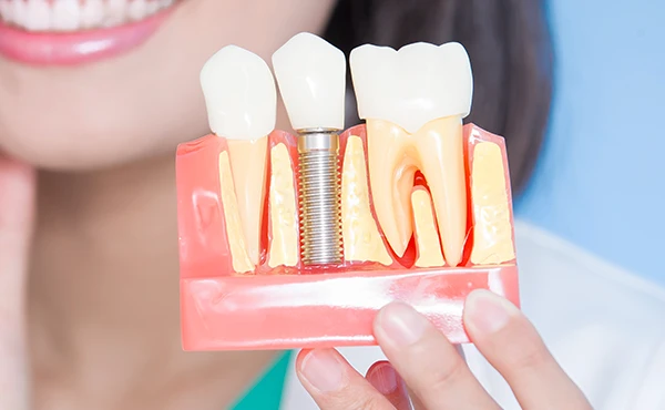 事前にCT検査を行い、顎の骨の状態を詳細に分析したうえで治療計画を立案します