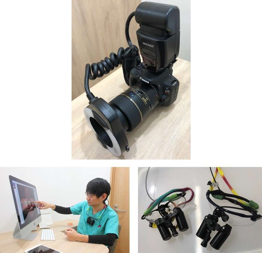 口腔内を撮影するカメラと拡大鏡