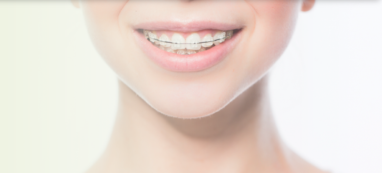 透明な装置を使用した「表側矯正（クリアブラケット矯正）」を取り扱っています