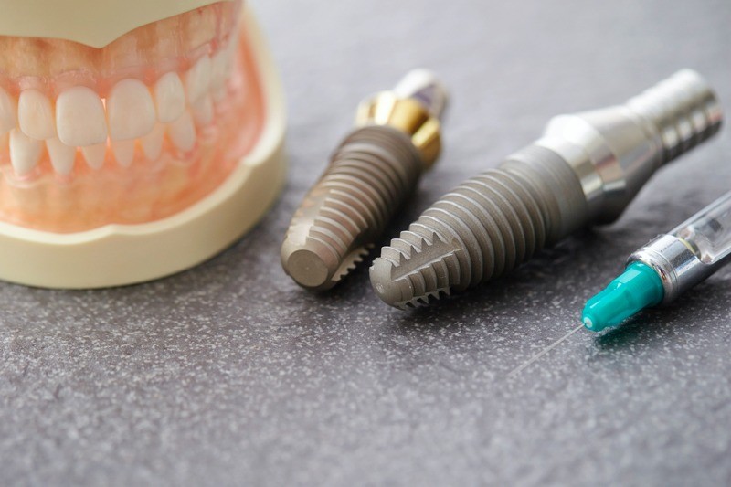 見た目だけでなく噛む力や会話のしやすさも自然に再現できます。