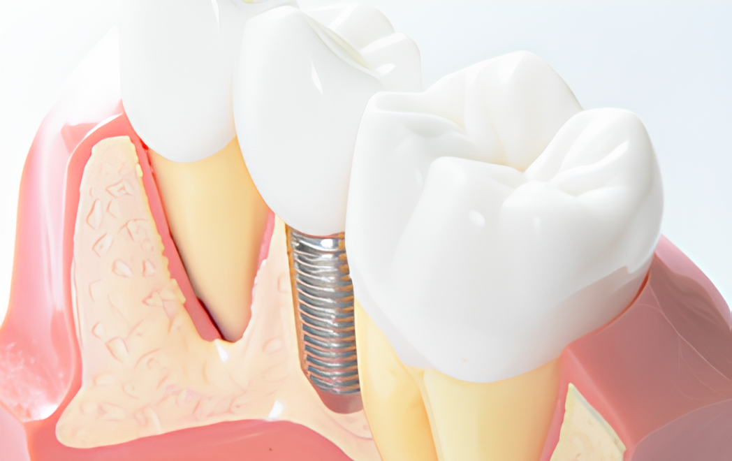 CT診断と先進技術で安全確実な歯の機能回復を提供