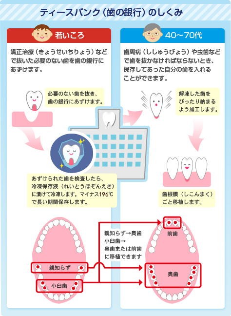 ティースバンクの仕組み