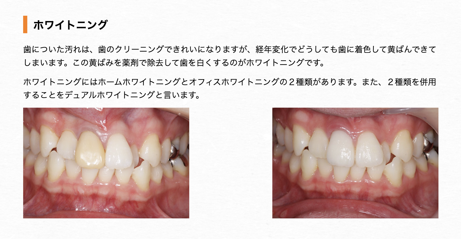 患者様のお口の美しさと健康を保つための審美歯科治療を行っています