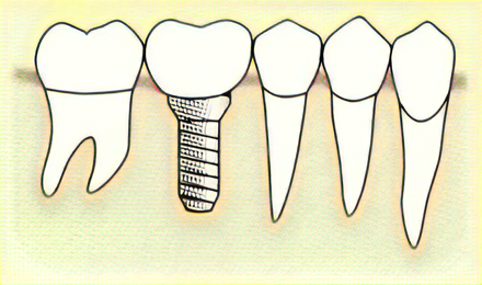 慎重な計画と段階を踏んだ治療によって、患者様に最適な結果を提供します。