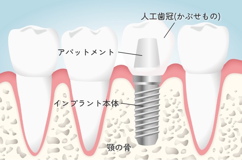※画像はイメージです。