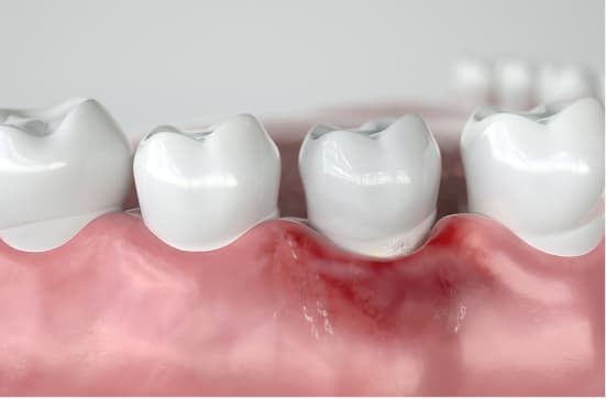 早めの受診をおすすめします