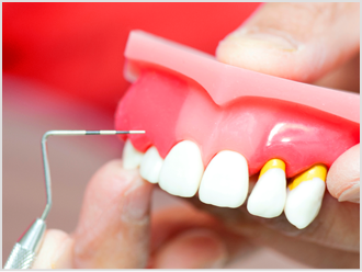 笹出線歯科クリニックの院長が担当いたします