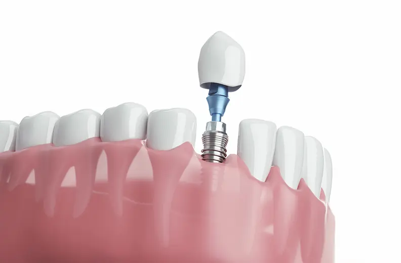 噛み心地と見た目を自然に近づけます