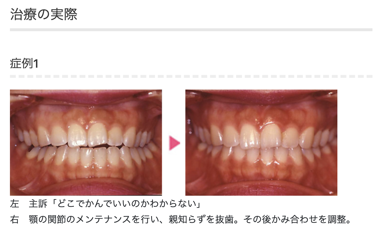 長期的に安定した口腔内環境を目指した治療を心がけています