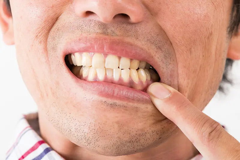 歯周病の進行を防ぎ、健康な歯と笑顔を守りましょう