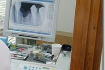 デジタル技術を駆使した、精度の高いインプラント治療を提供