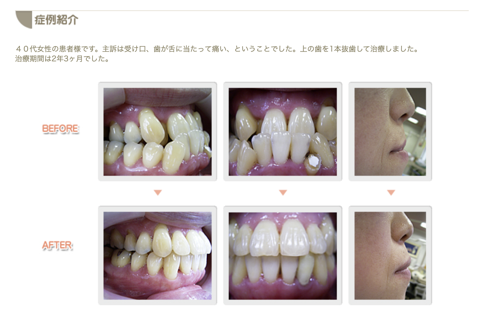 矯正歯科専門医が在籍し、患者様一人ひとりの状態に合わせた治療計画を提案しています