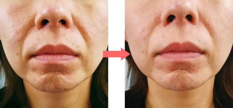 お口周りの血行を良くし、ハリやつやをもたらすことができます