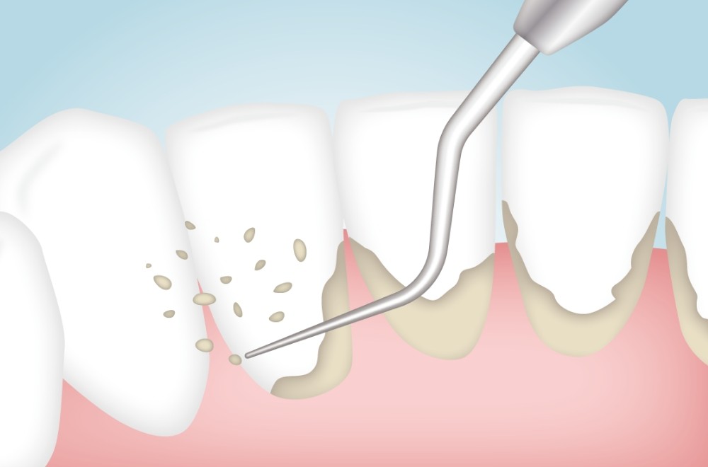 ※画像はイメージです。