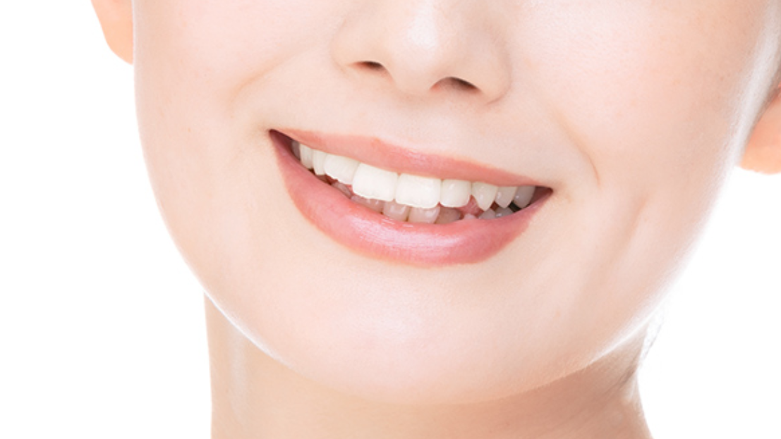 ホワイトニング