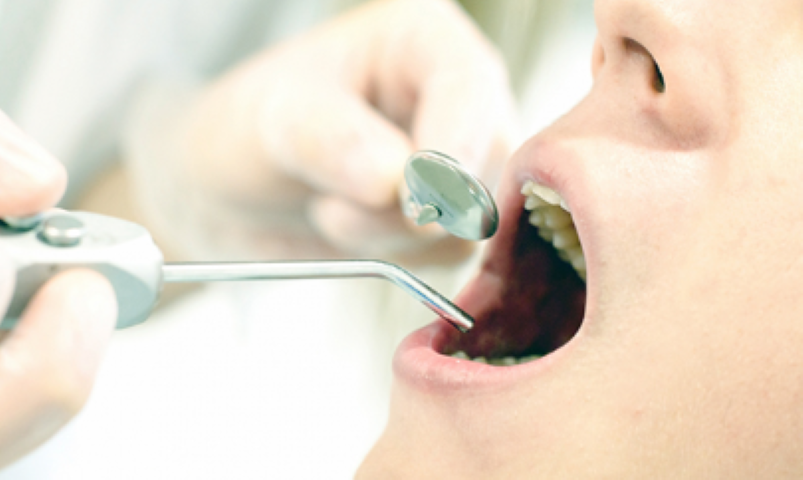 経験豊富な院長が提供する最適な入れ歯治療