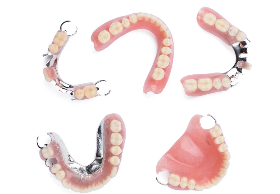 快適な装着感と審美性を追求した入れ歯治療