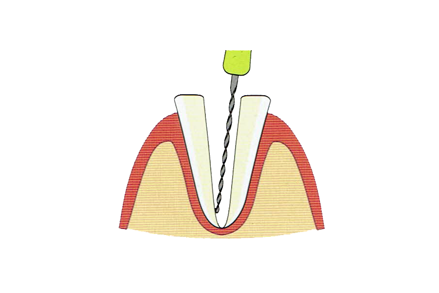 精密な治療と治療後の歯のケアを重視しております