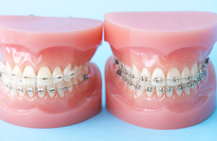 矯正歯科・審美歯科専門です