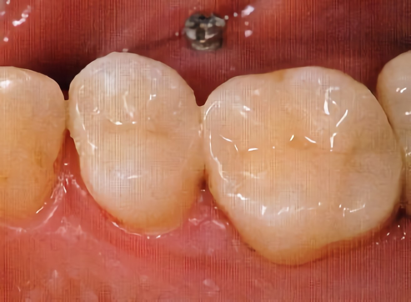 白く美しい歯を保ちます