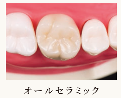 様々な種類の被せ物をご用意しています