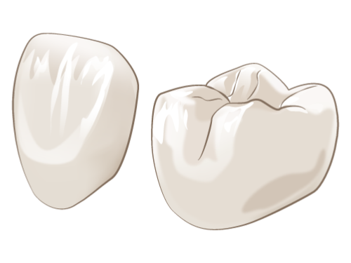 接着性レジンやセラミックスを用いたメタルフリー治療で金属アレルギーの心配がありません