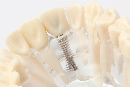 無料カウンセリングを実施しています