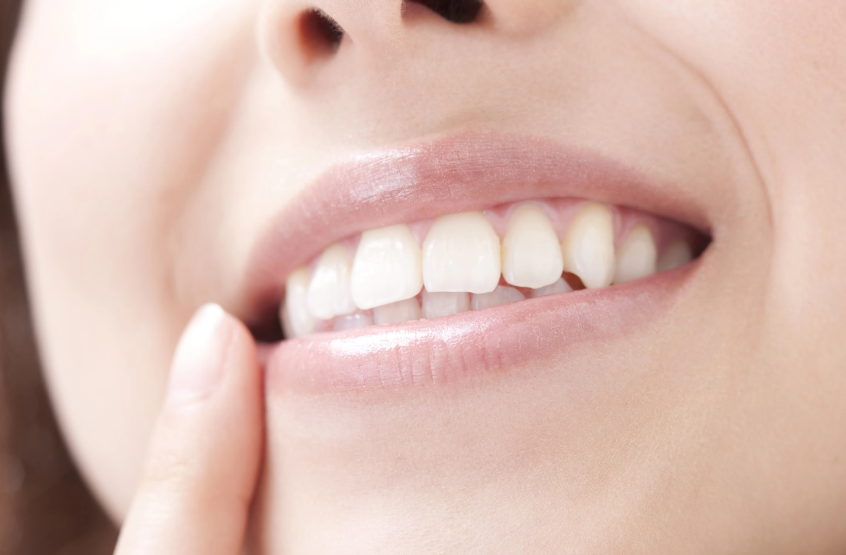 青色LEDシステムと高品質素材で審美性と健康を両立する歯科治療