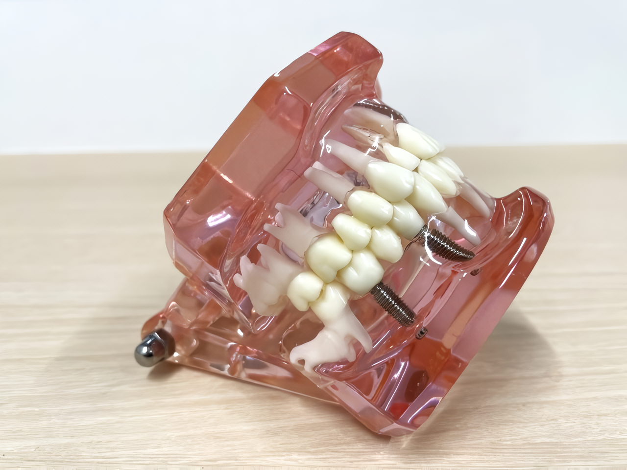 インプラント治療を体験してみませんか