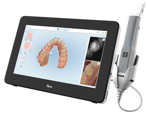 口腔内スキャナー