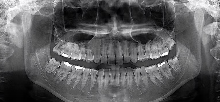 豊富な経験と高度な技術