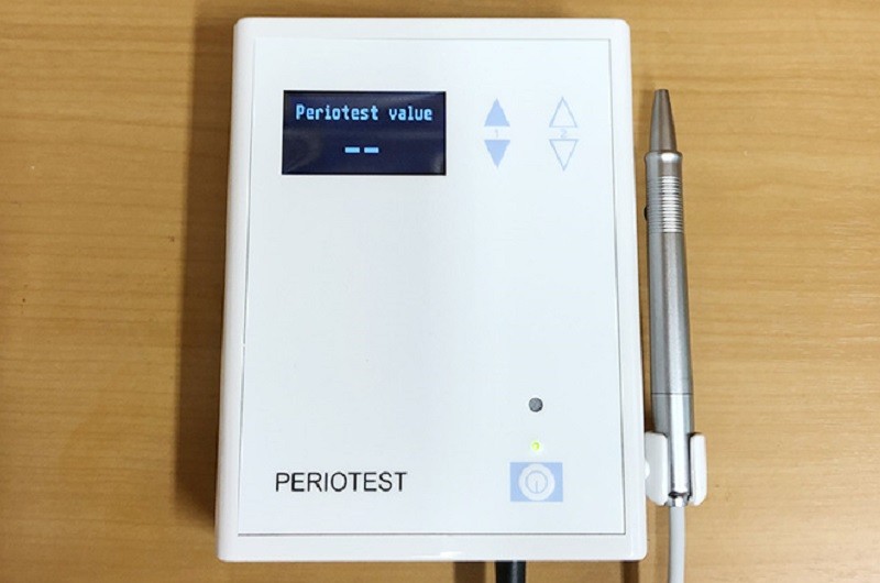 ペリオテストを行うと歯周病の経過観察が行えます